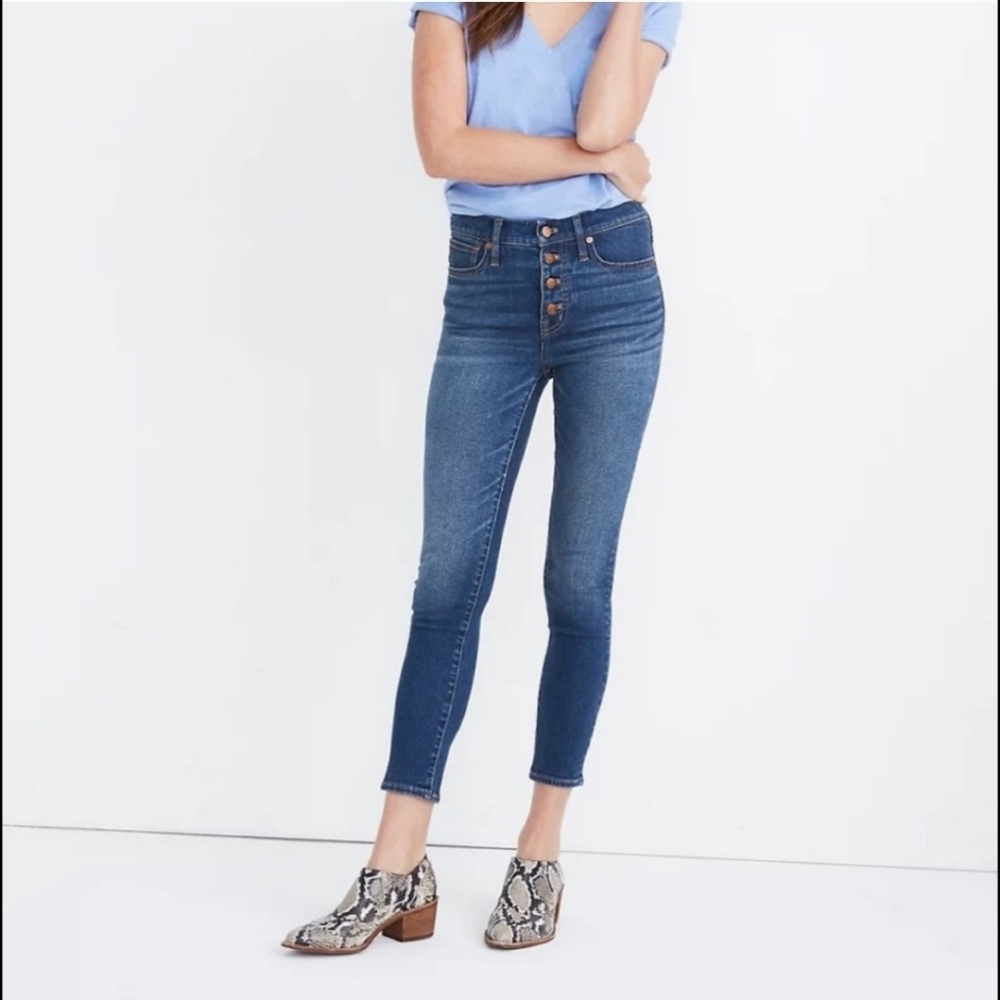 Madewell 9" mid rise Cropped Skinny Jeans Dewey wash exposed button fly sz 30